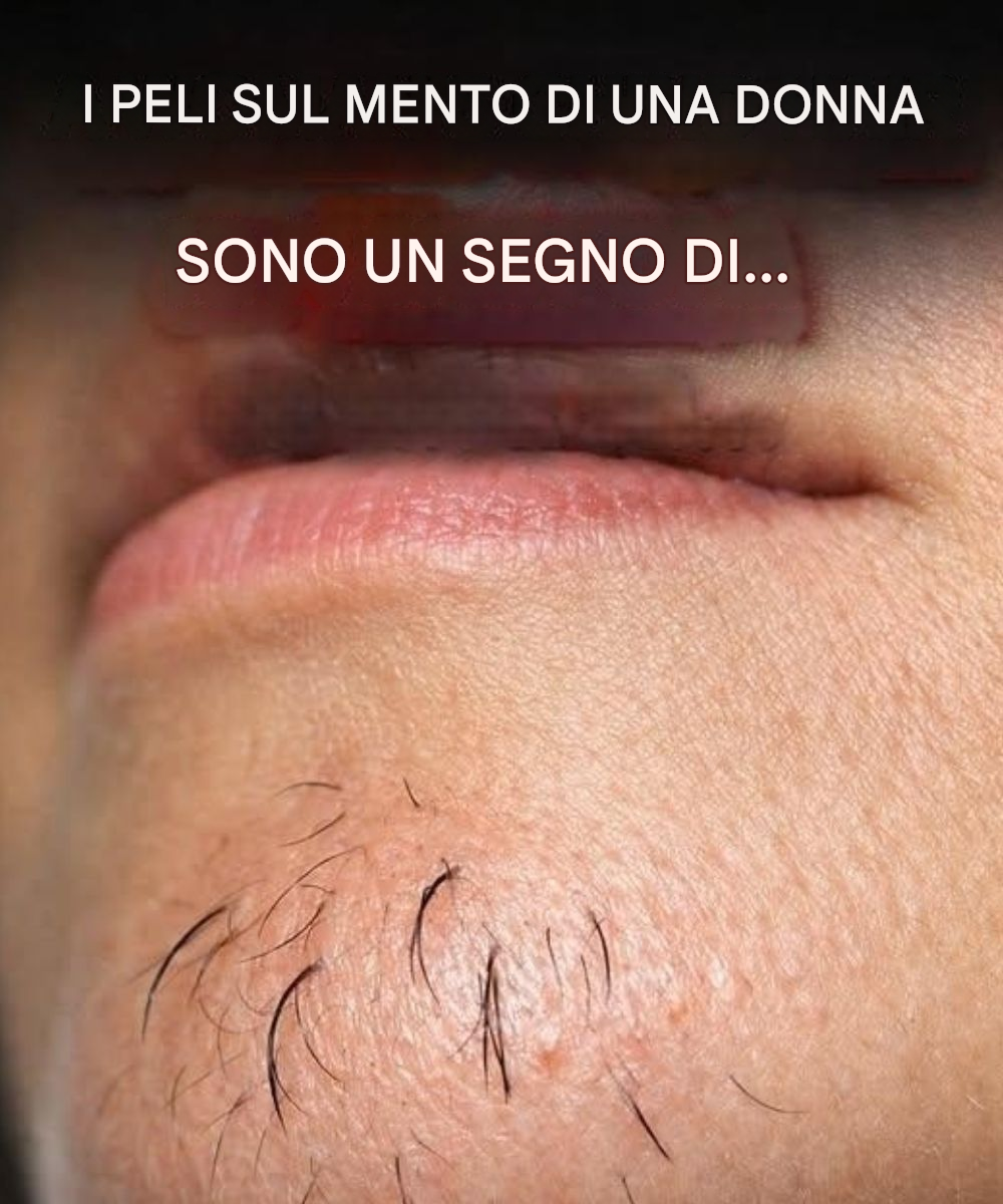 In che modo lo stress e l’alimentazione influenzano la crescita dei peli sul mento nelle donne?